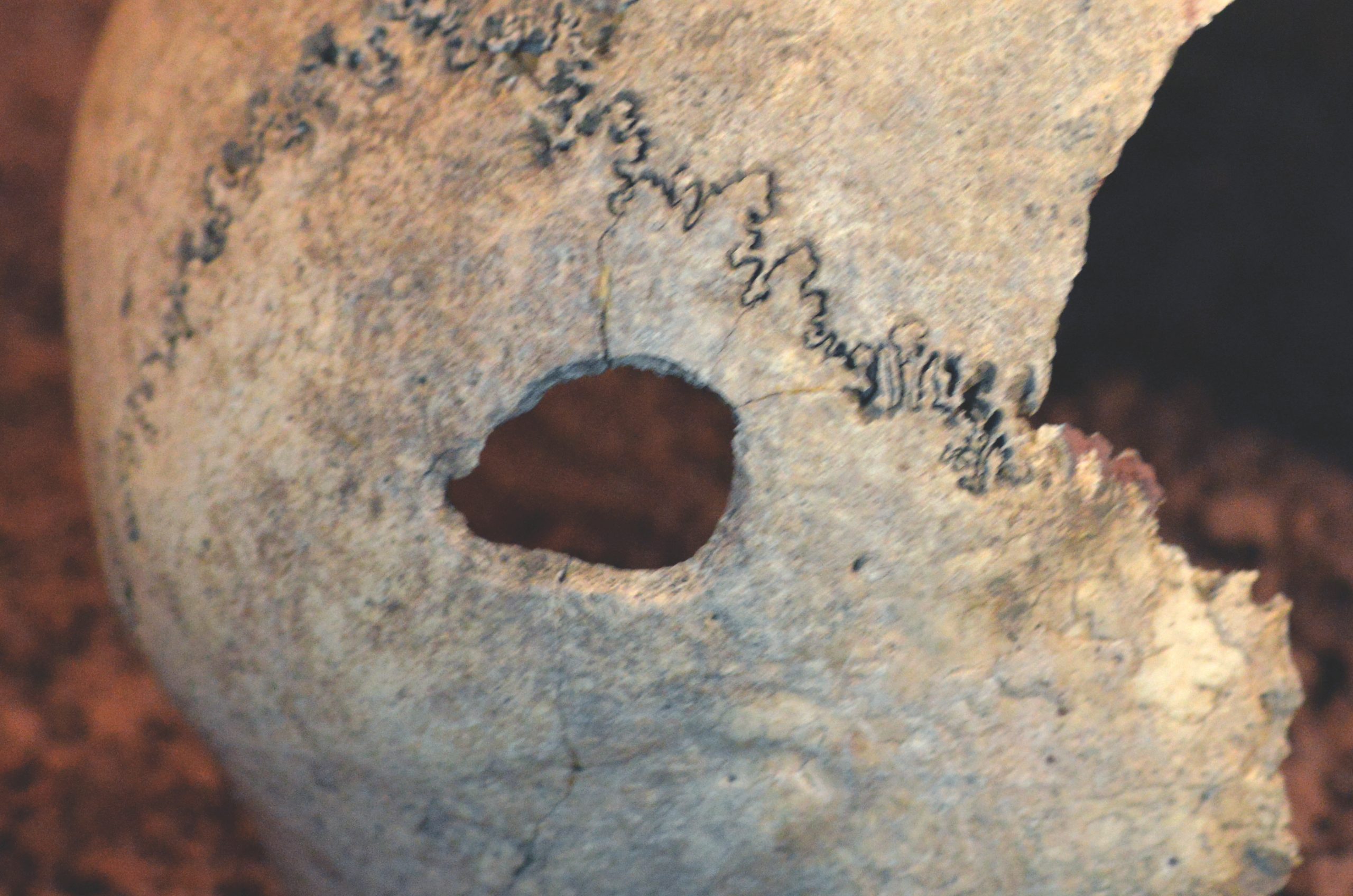 Trépanation, Grotte des Caïres à Laissac (Aveyron)