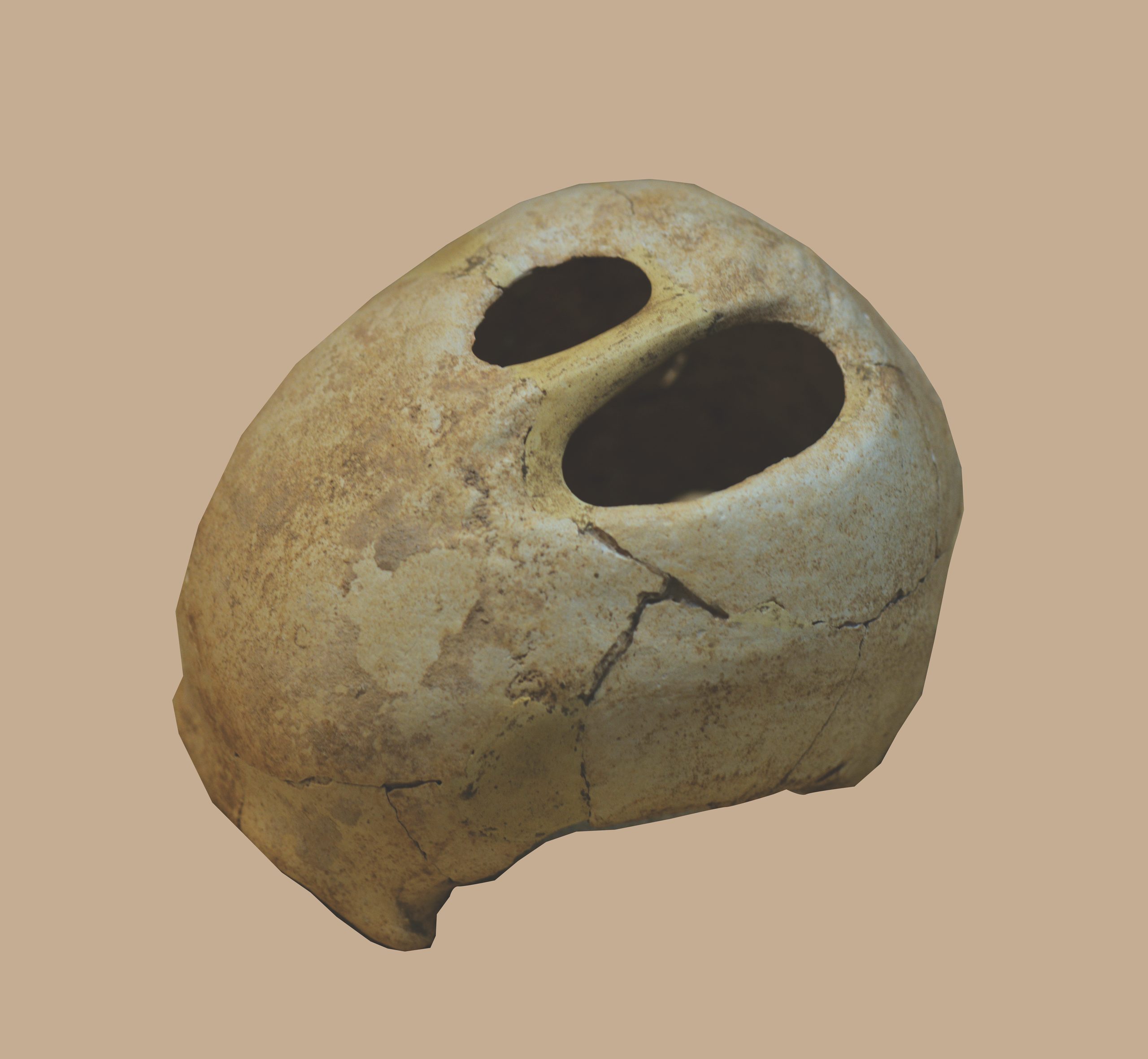 Crâne avec deux trépanations, Grotte de Merdoplau à Creissels (Aveyron), musée de Millau.